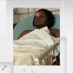 Teens and Boy Injured by Fireworks and Stray Bullet During South Florida 4th of July Celebrations