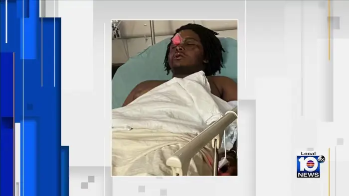 Teens and Boy Injured by Fireworks and Stray Bullet During South Florida 4th of July Celebrations